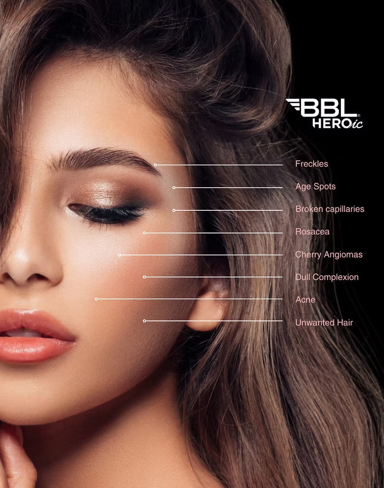 Bbl-hero-5 (1) Bbl hero 5 1